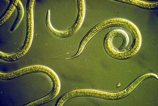 Gusanos nematodos parásitos en el intestino delgado humano